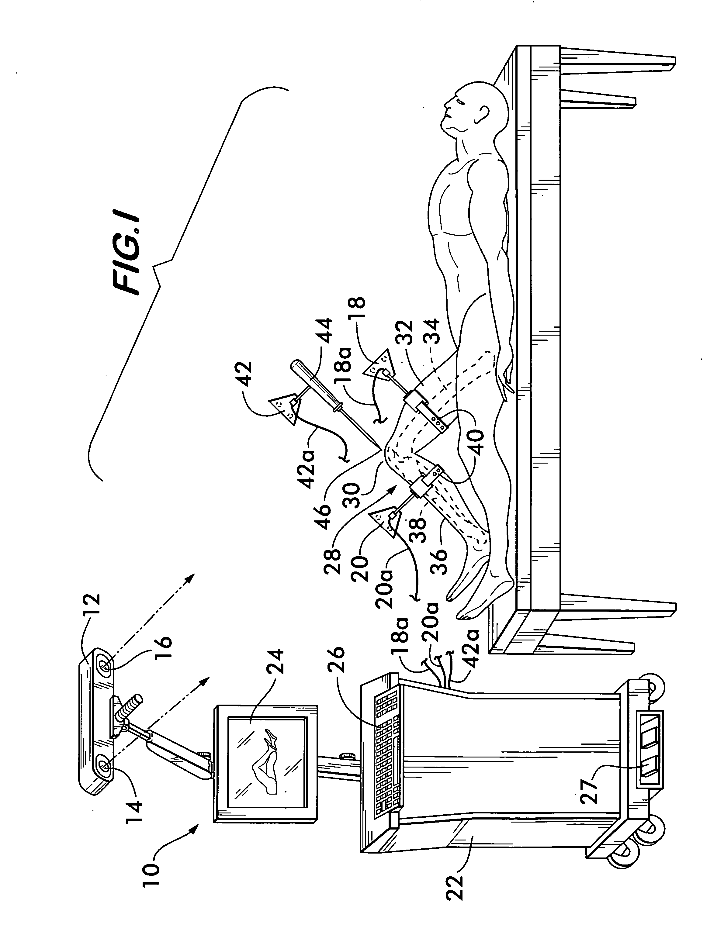 Method of determining the position of the articular point of a joint