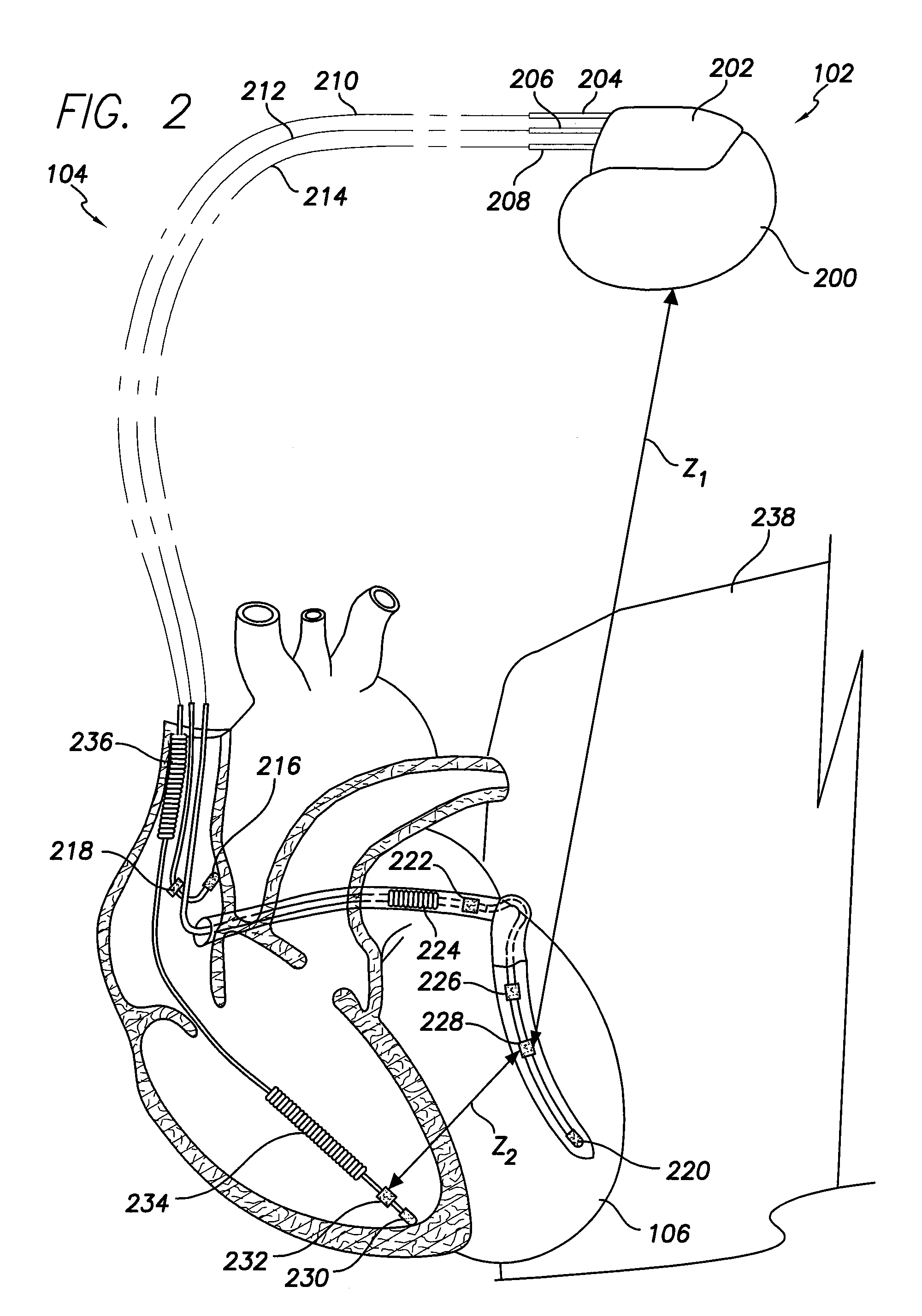 System and method for identifying a potential cause of pulmonary edema