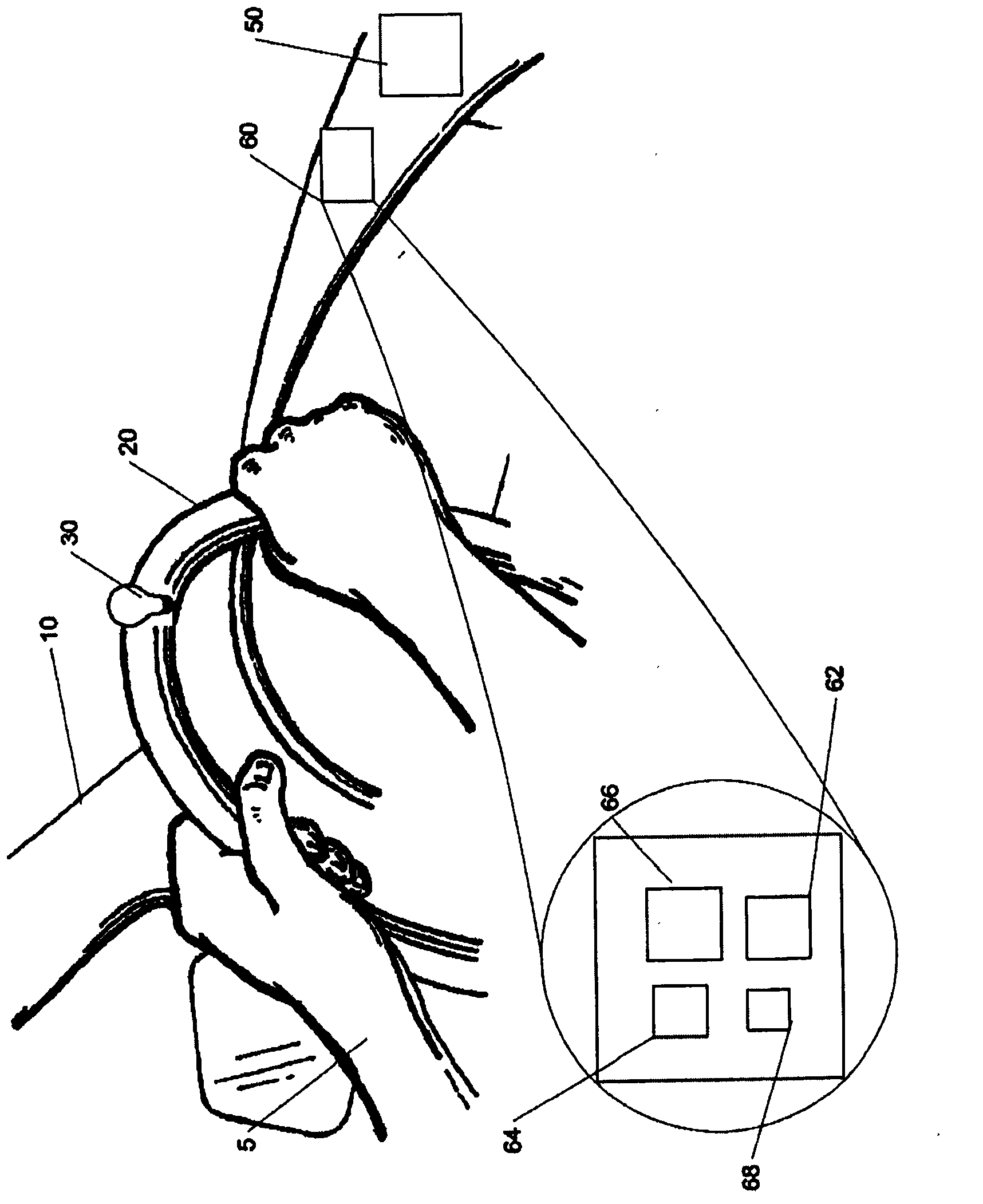 System And Method For Closed-loop Driver Attention Management