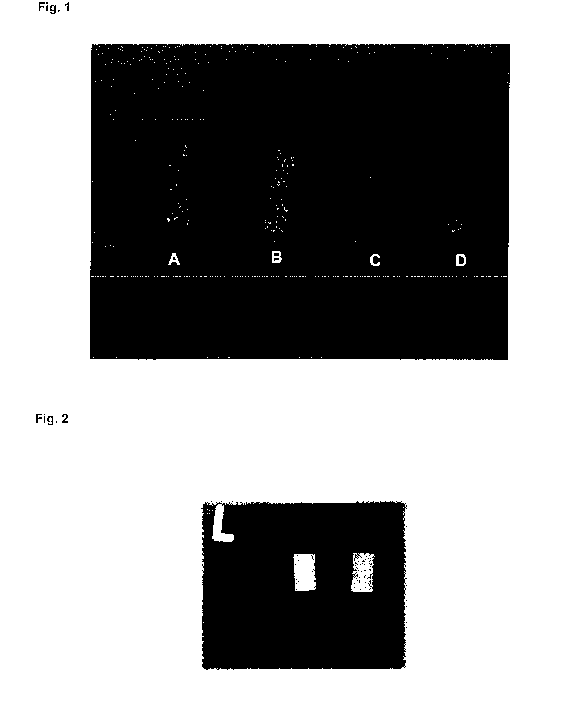 Biodegradable composite material