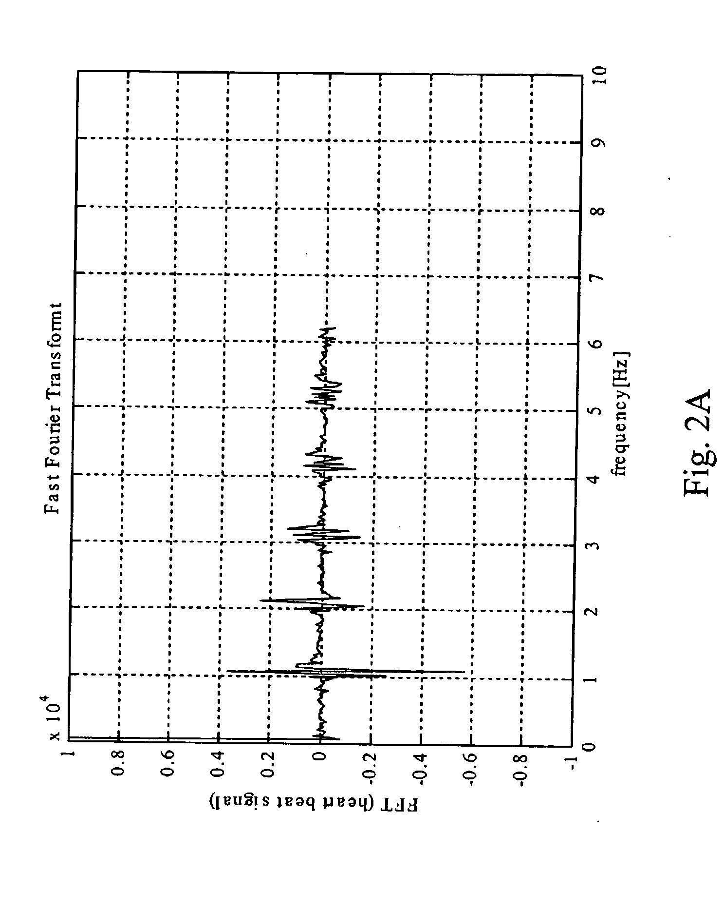 Heart state monitor method