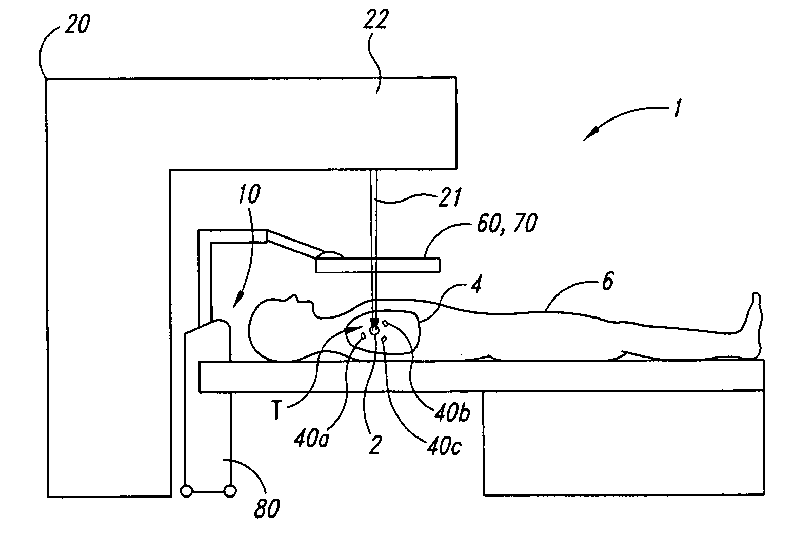 Systems and methods for real-time tracking of targets in radiation therapy and other medical applications