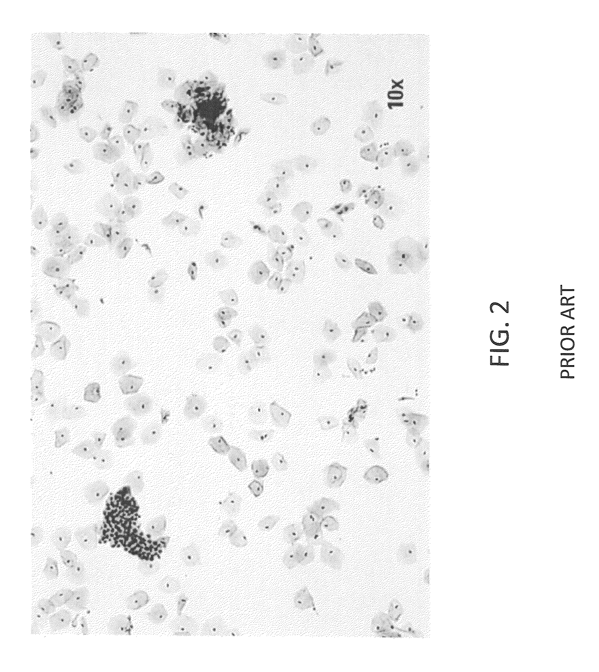 Method and system for analyzing biological specimens by spectral imaging