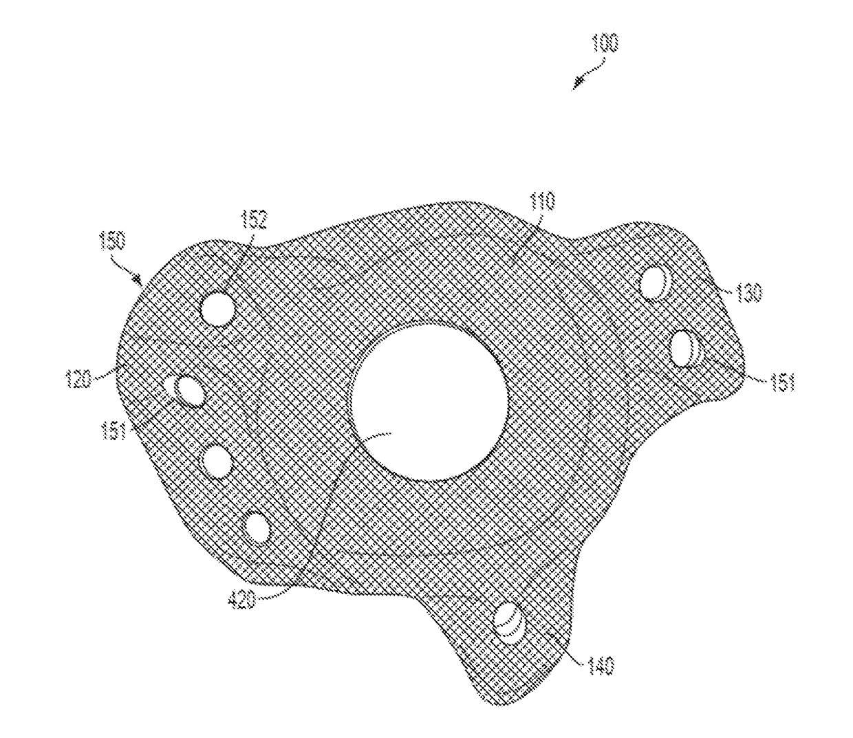 Implant Surfaces