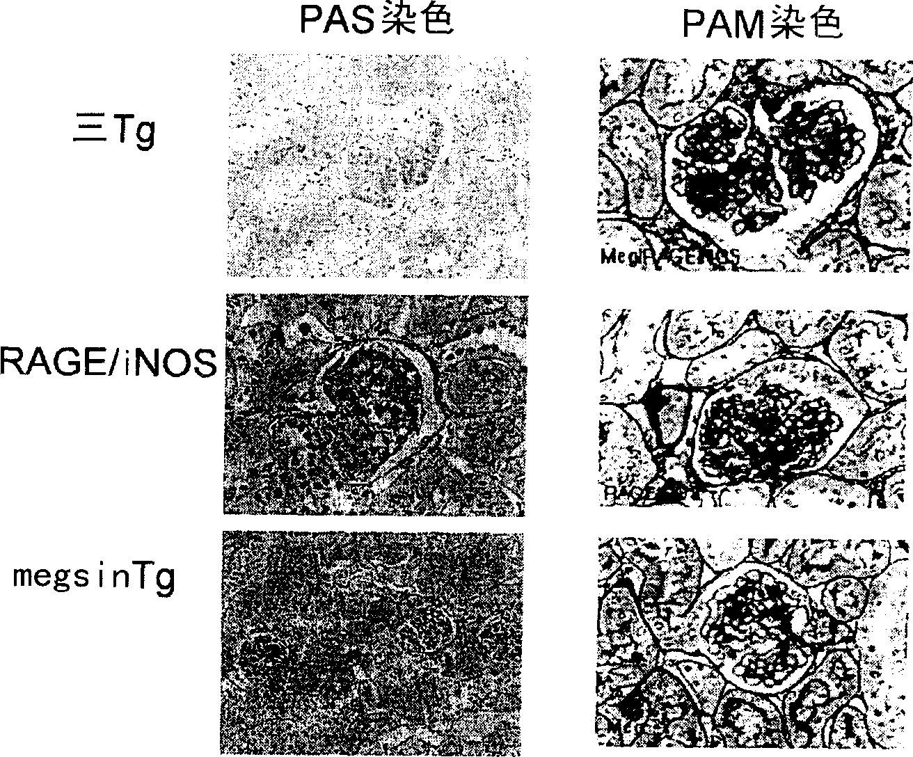 Disease model animal expressing MEGSIN/RAGE/iNOS and method of evaluating compound with the use of the animal