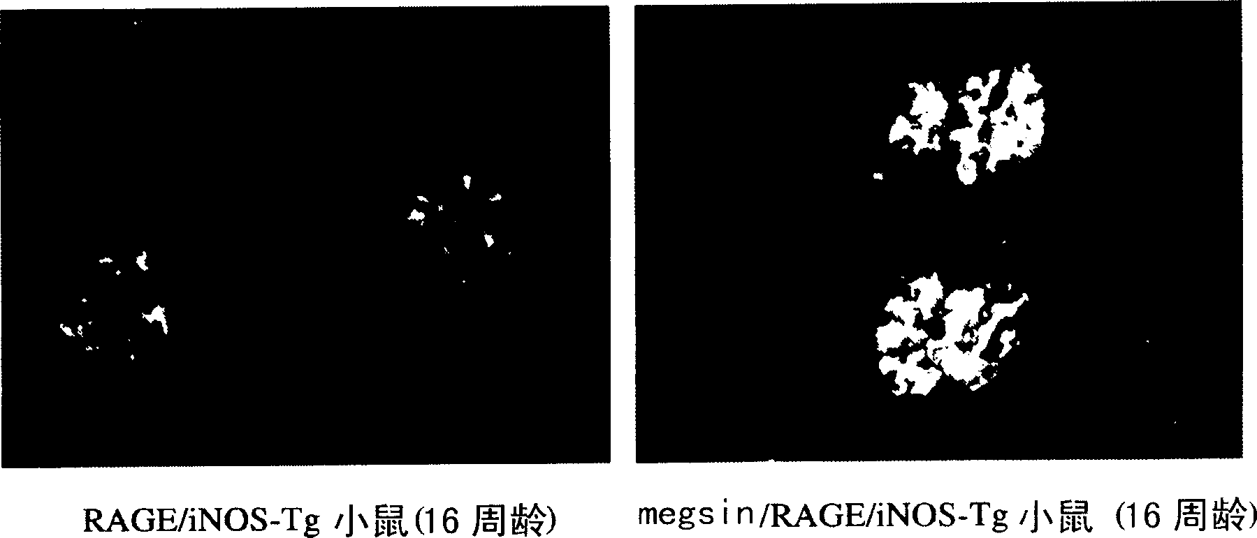 Disease model animal expressing MEGSIN/RAGE/iNOS and method of evaluating compound with the use of the animal