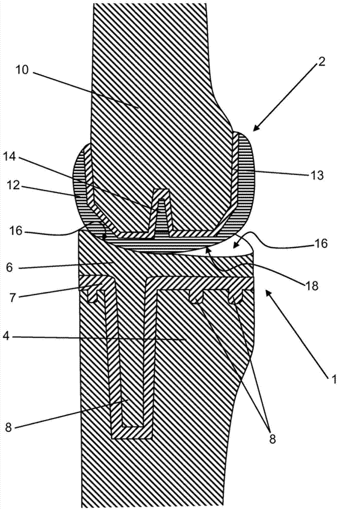 Two-part articulating joint spacer and method for producing said joint spacer