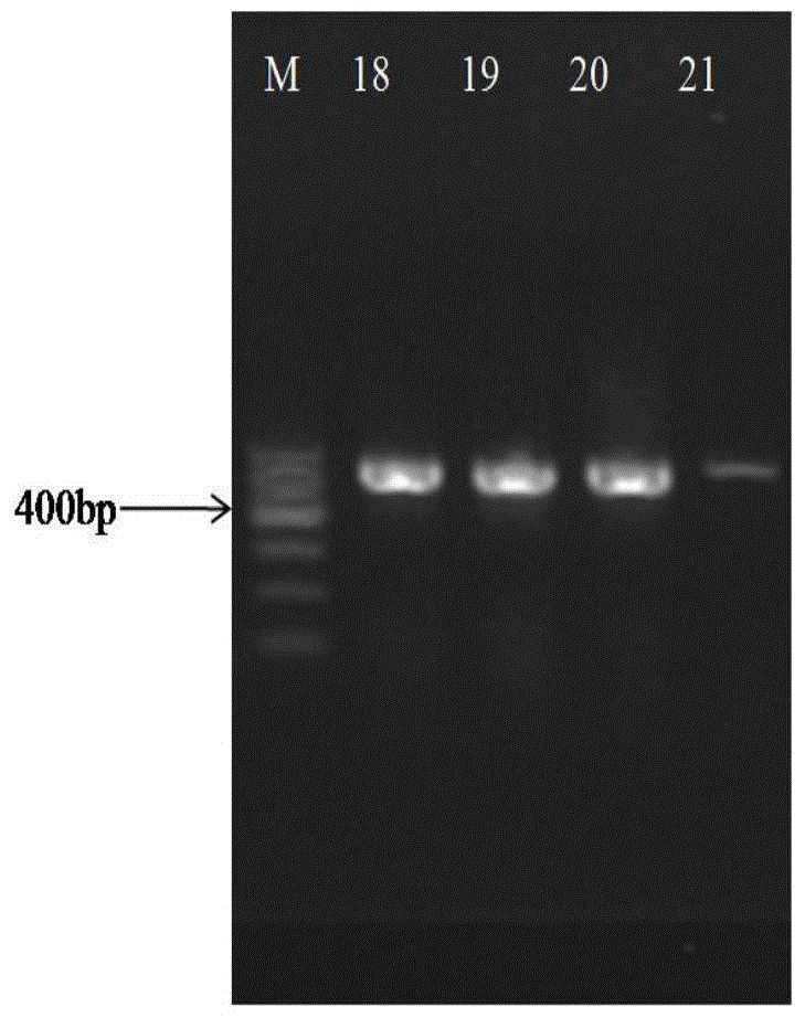 A kind of method for detecting Lactobacillus casei bacterial strain and its kit and primer pair