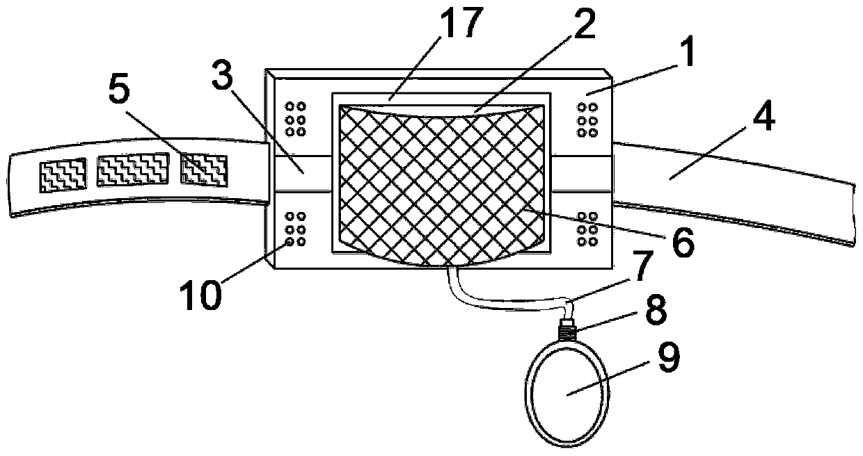 Hemostasis device for vascular surgery