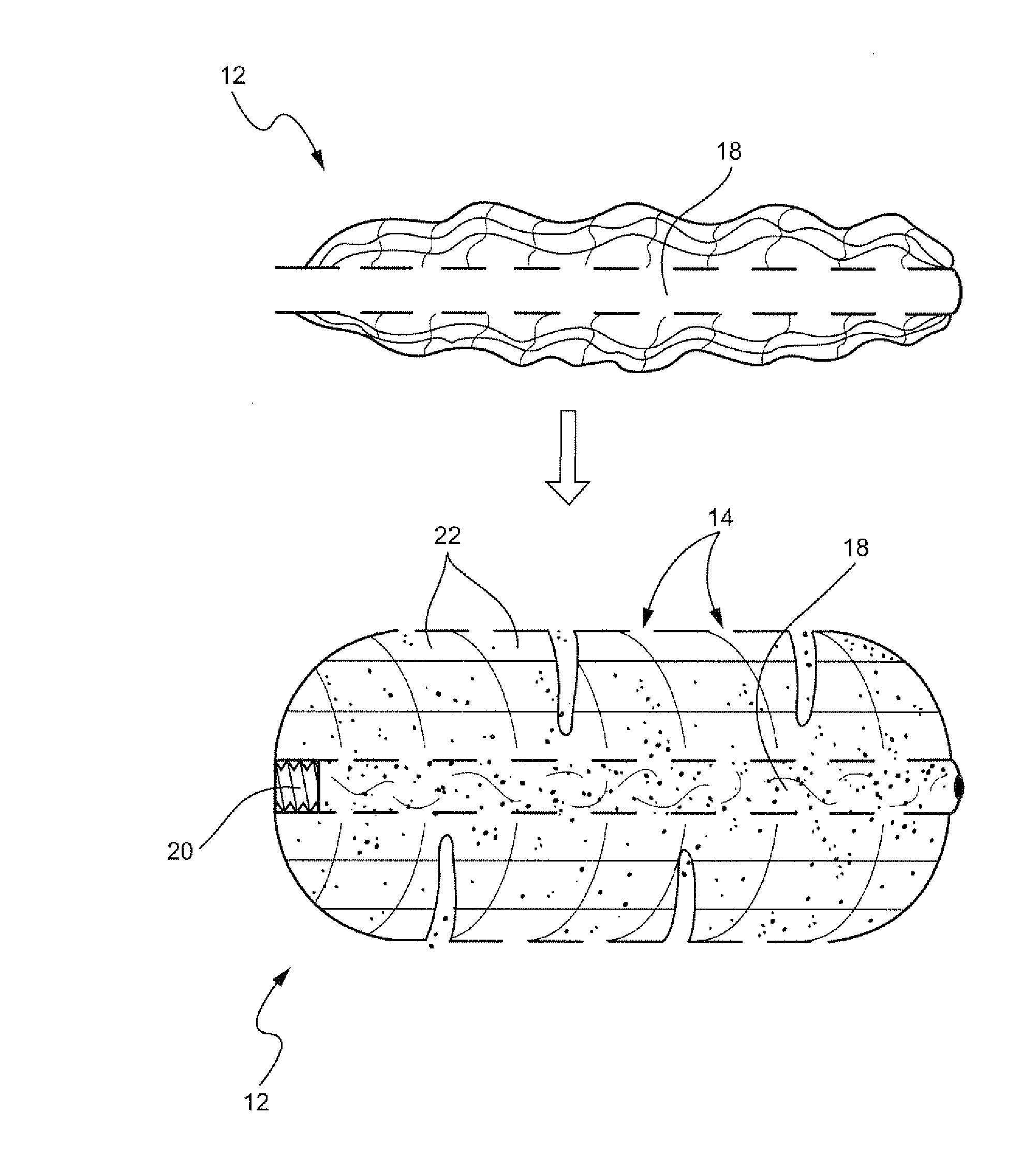 Biologic vertebral reconstruction