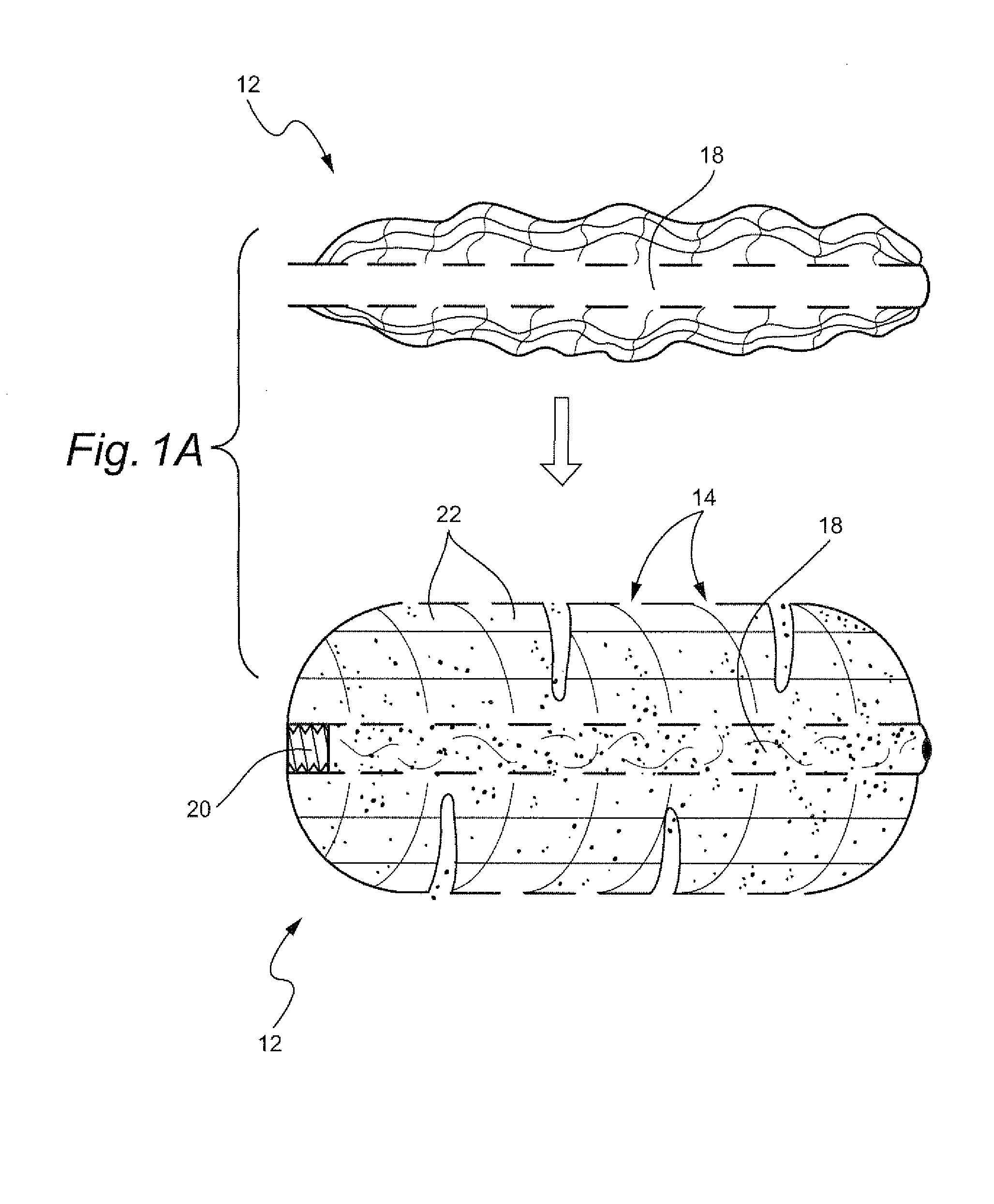 Biologic vertebral reconstruction