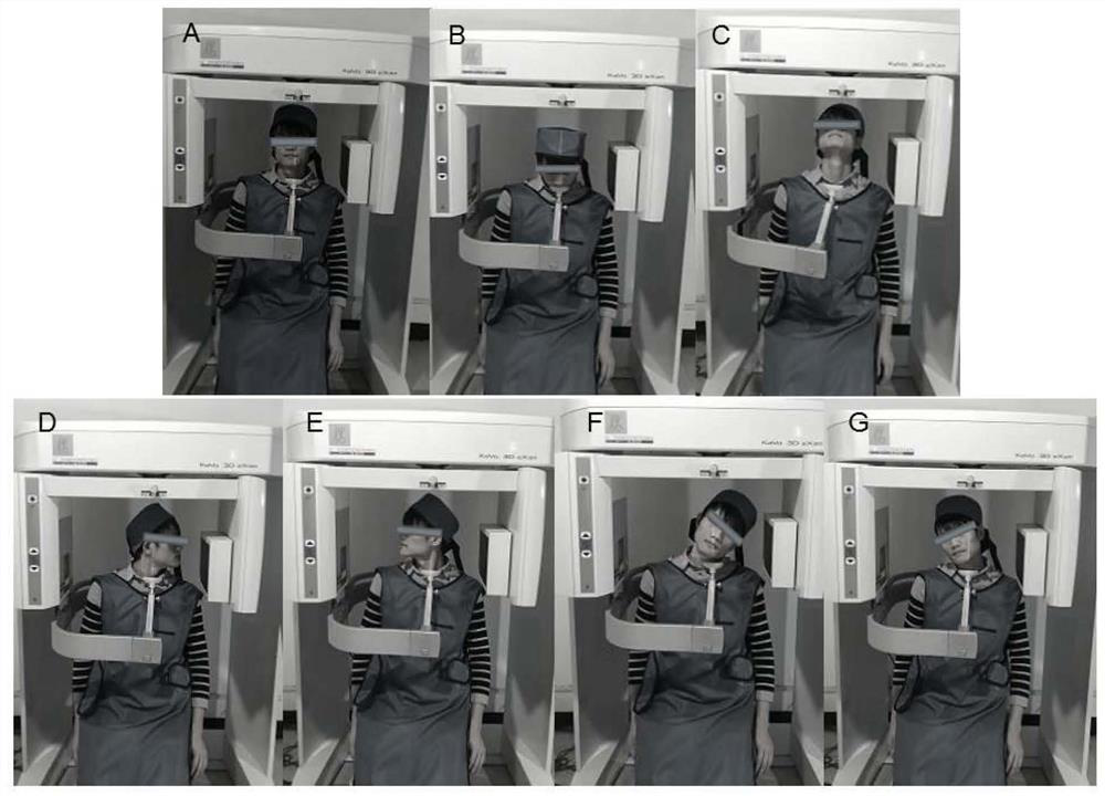 Cone beam CT and image fusion combined cervical vertebra in-vivo three-dimensional motion analysis method