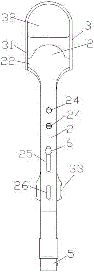 tonsillectomy device