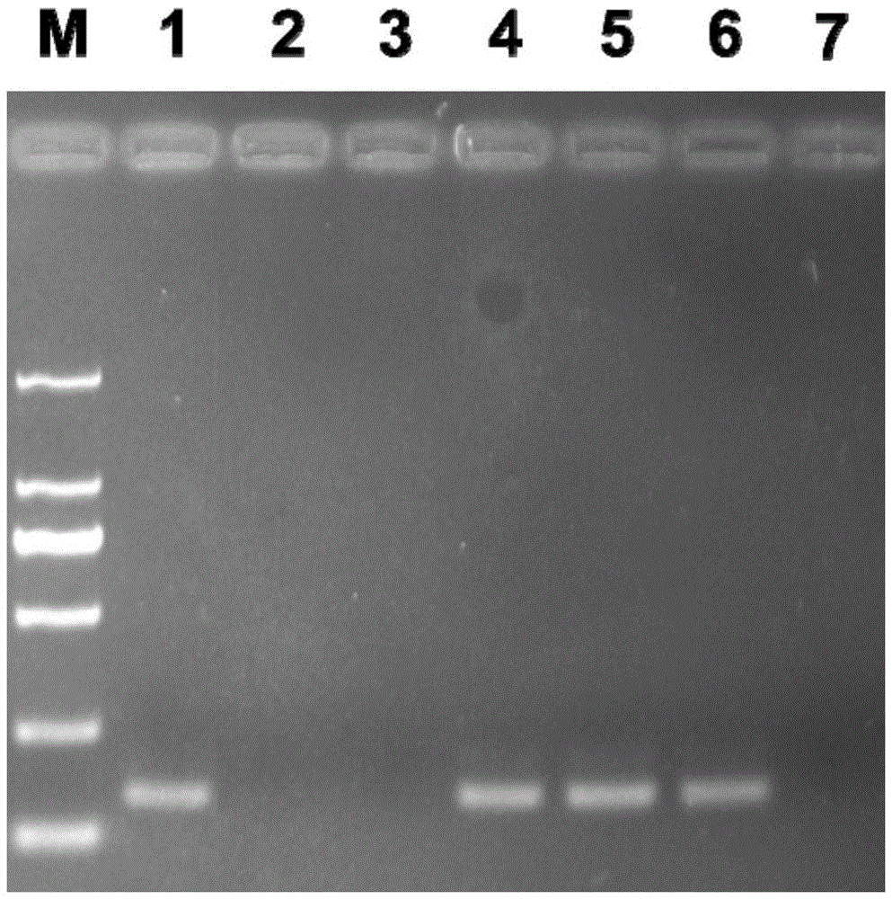 The pcr detection primers of spruce dwarf mistletoe and its application and pcr detection method