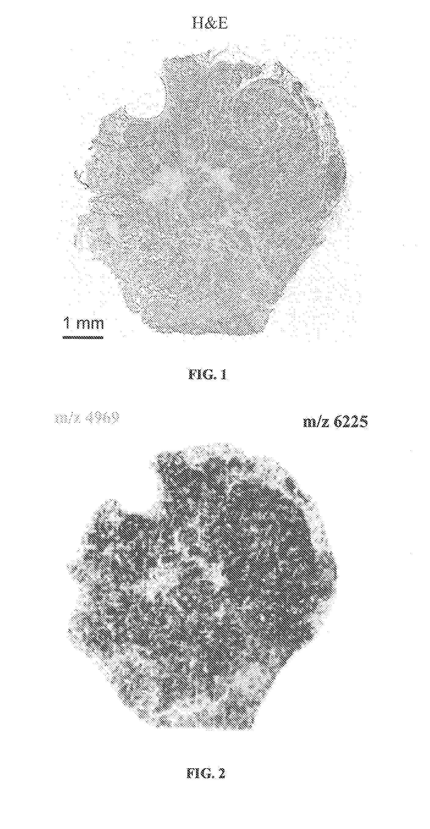 Determining an expression status of human epidermal growth factor receptor 2 (HER2) in a biological sample