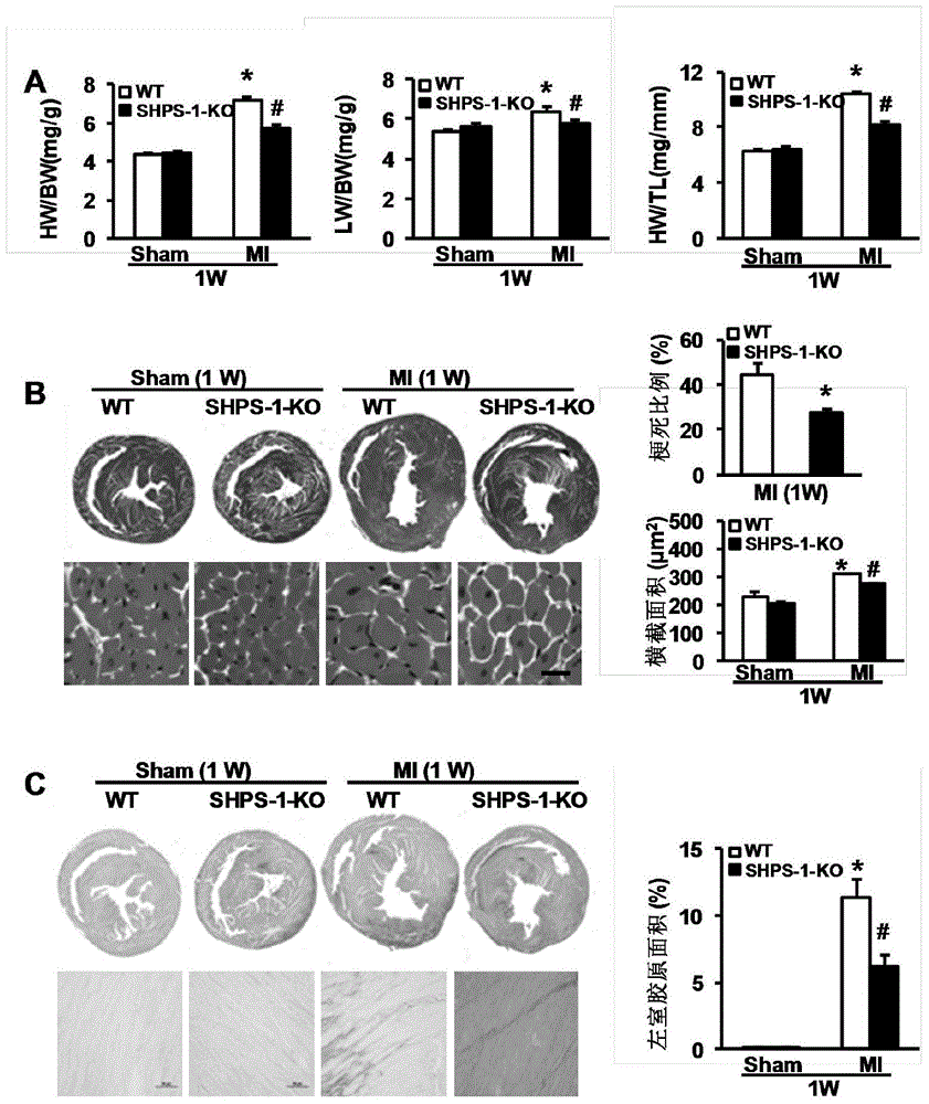 Application of Signal Regulatory Protein α (shsp-1) Gene in Myocardial Infarction