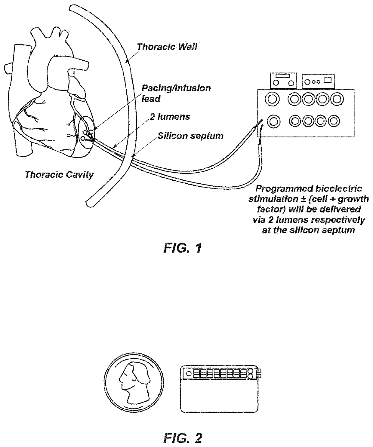 Bioelectric stimulator