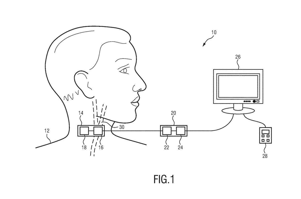 Monitoring apparatus for monitoring blood pressure of a subject