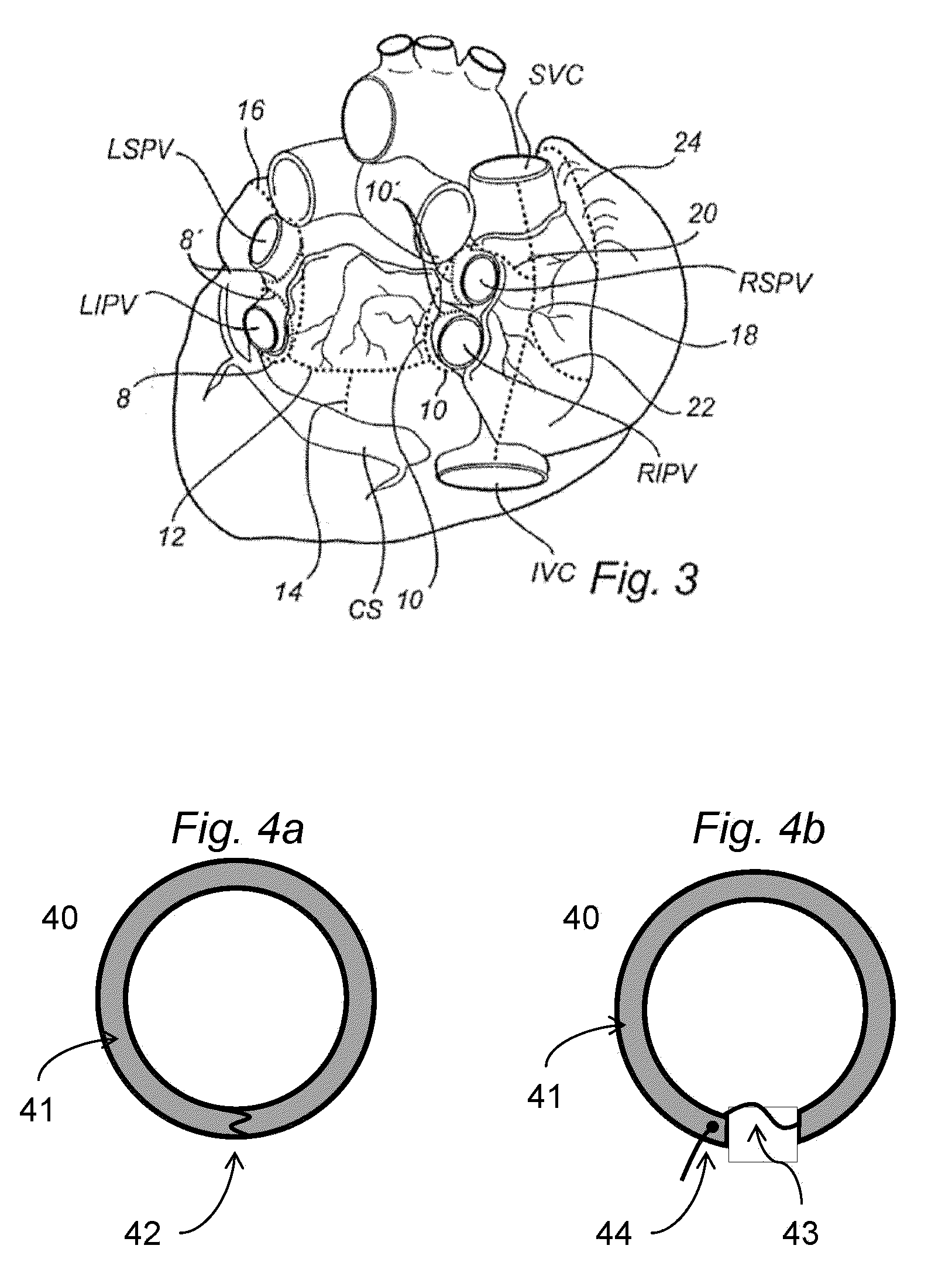 Shape-Changing Medical Device, Kit, Method Of Production, And Method Of Use