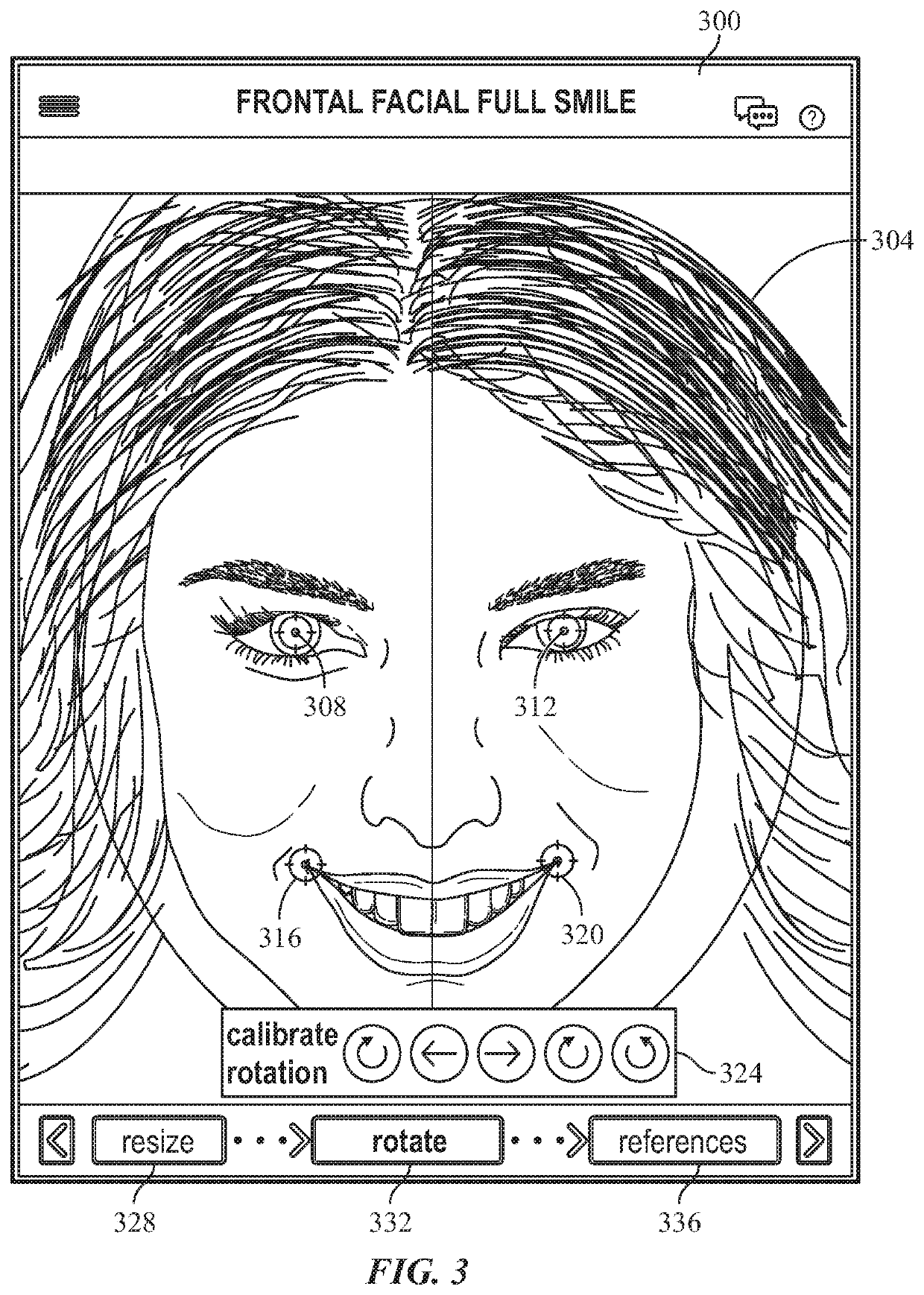 System and method for generating an orthodontic appliance