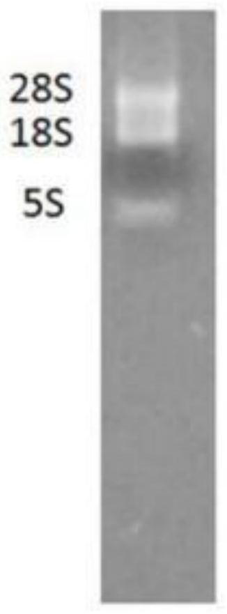 A kind of anti-ca125 nanobody 5d2 and its application