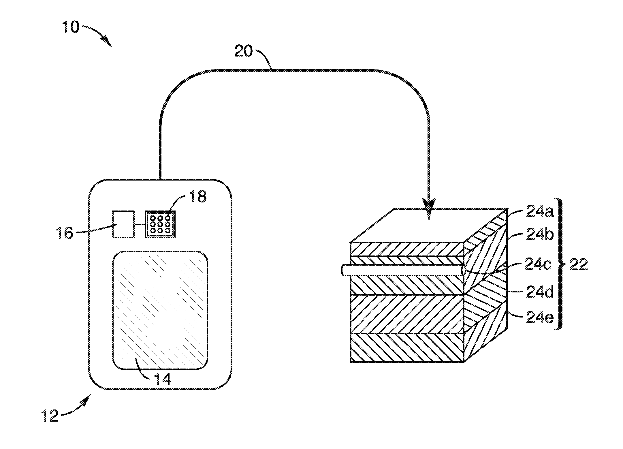 Miniature ultrasonic imaging system