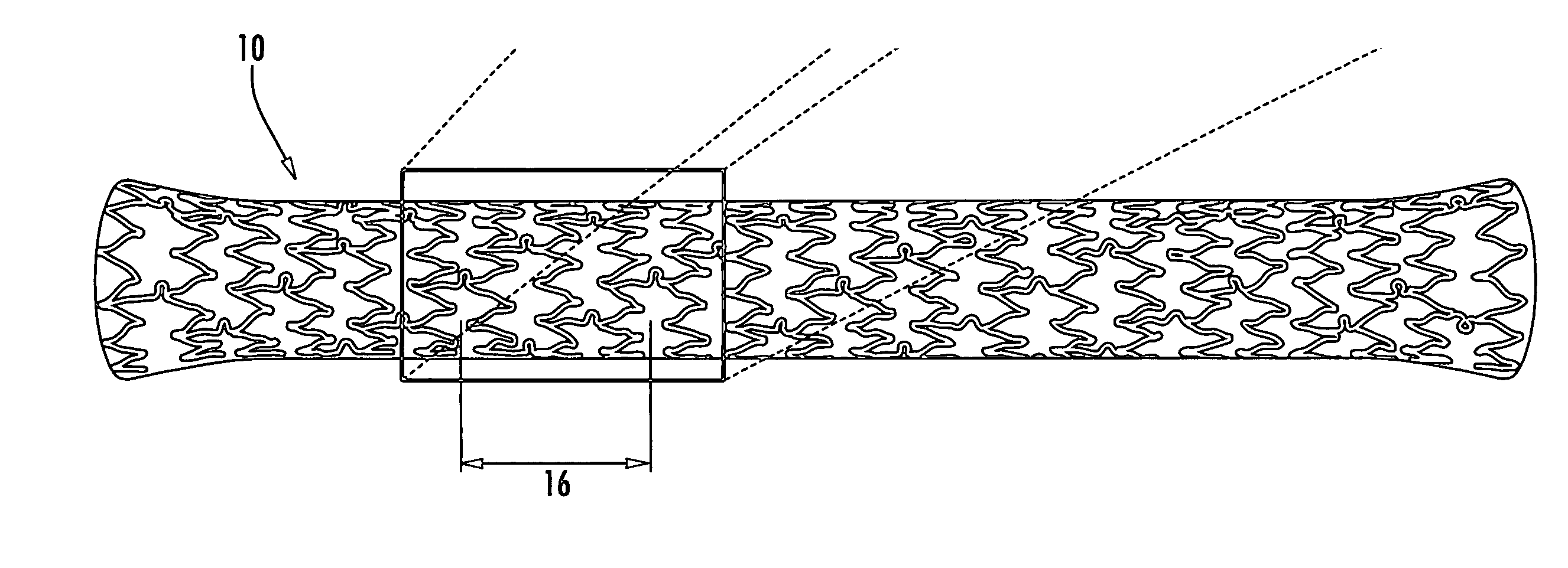 Drainage stent and associated method