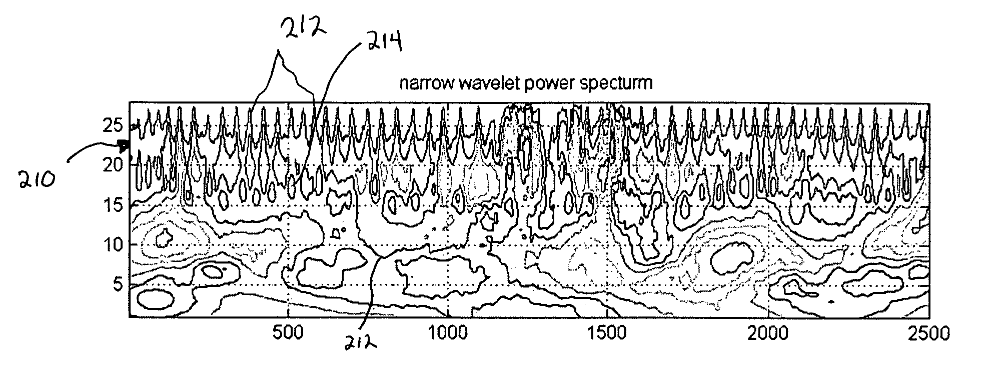 Wavelet transform of a plethysmographic signal