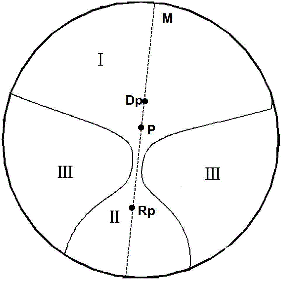 Blind zone optimized progressive eye lens and mold thereof