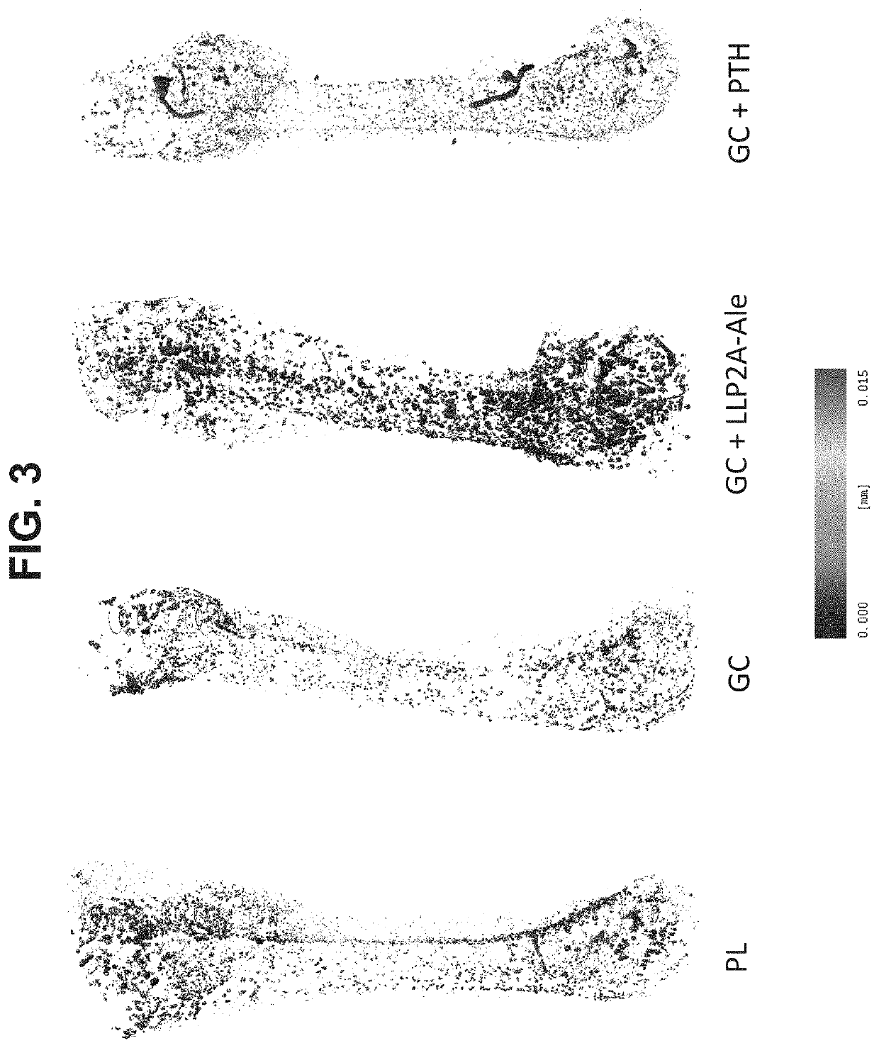 Methods of treating osteonecrosis with llp2a-bisphosphonate compounds