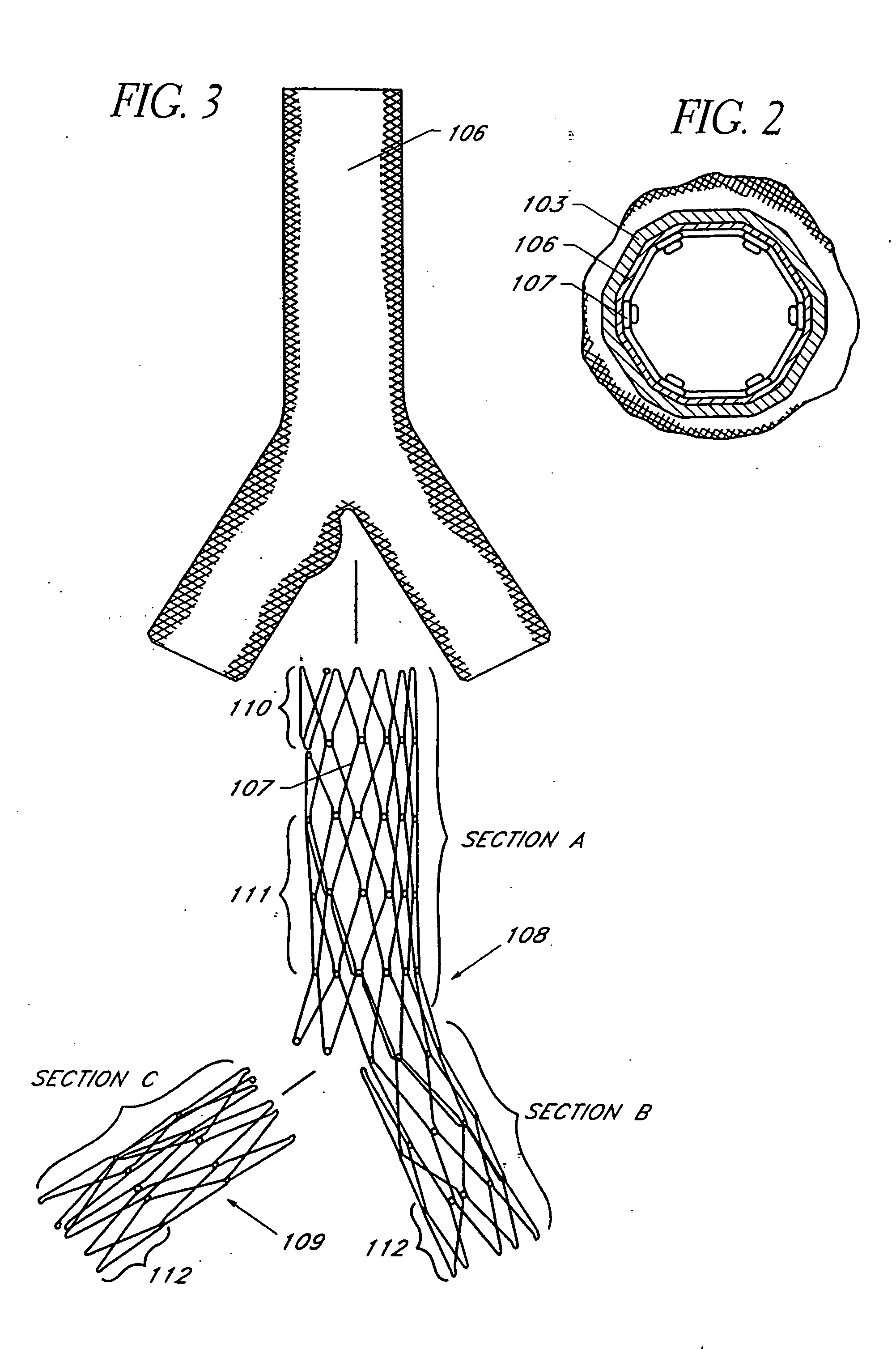 Bifurcation graft deployment catheter