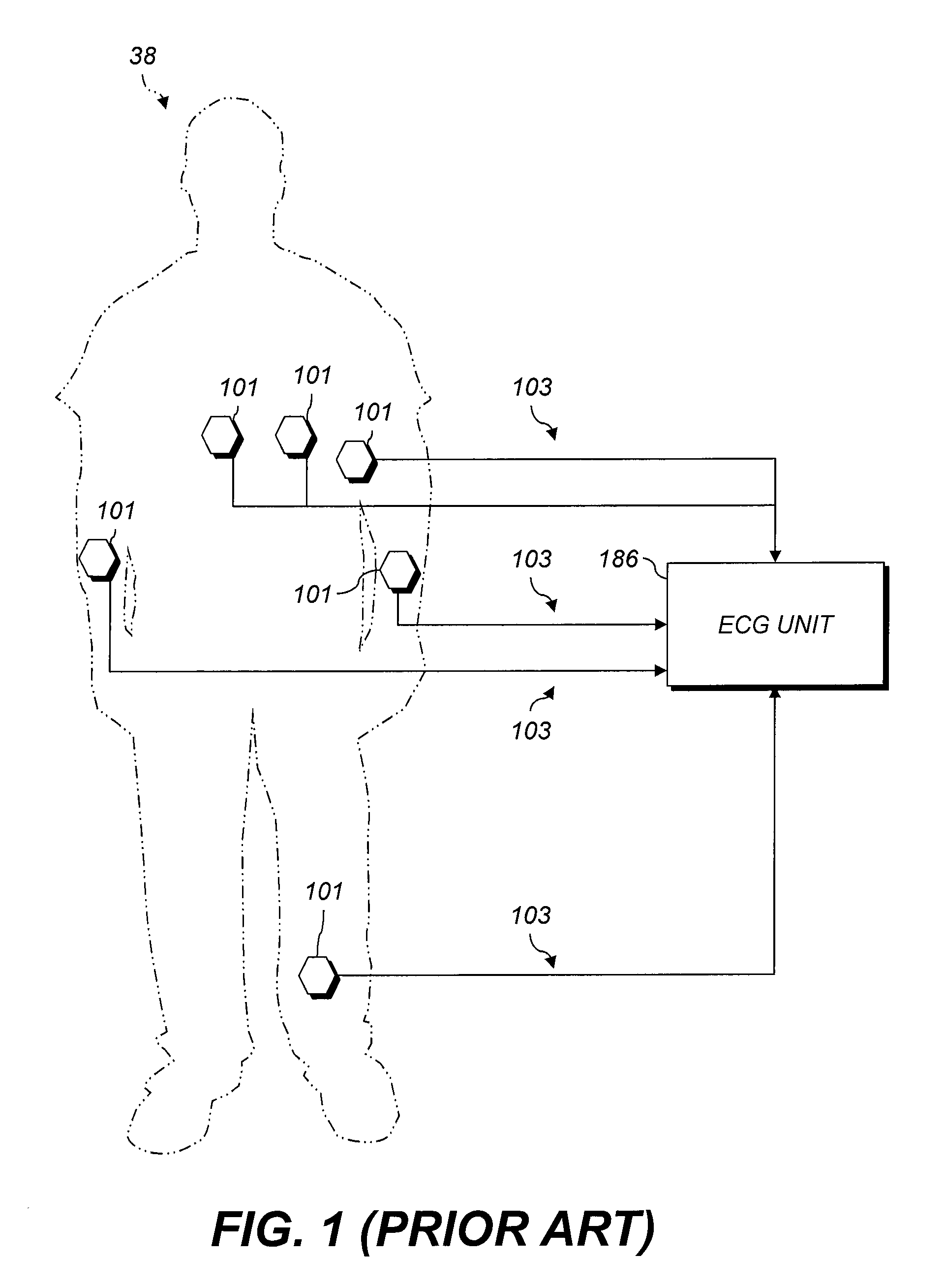 Electrode with charge-operated indicator