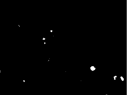 Adult sertoli cell-pancreas islet compound and preparation method for same