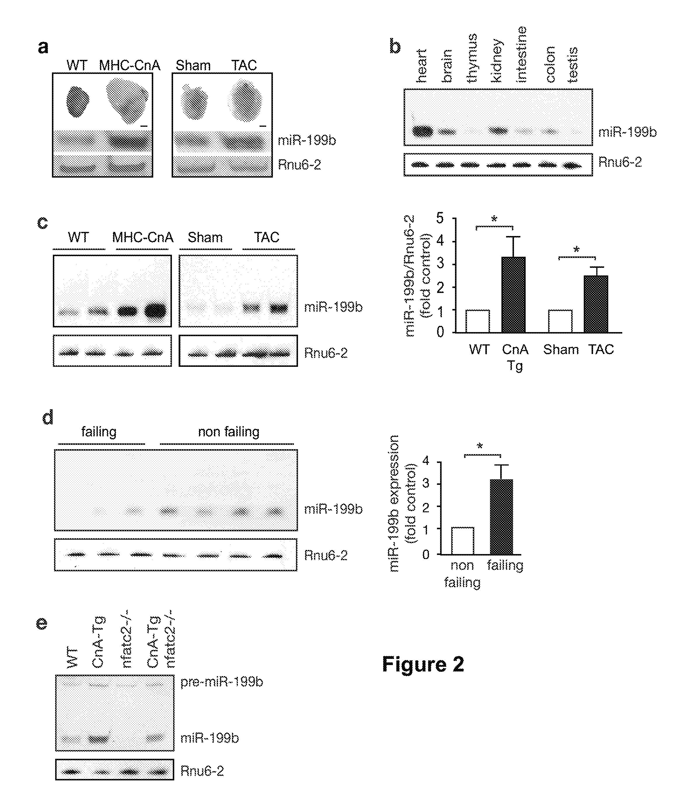 Means and methods for counteracting, delaying and/or preventing heart disease