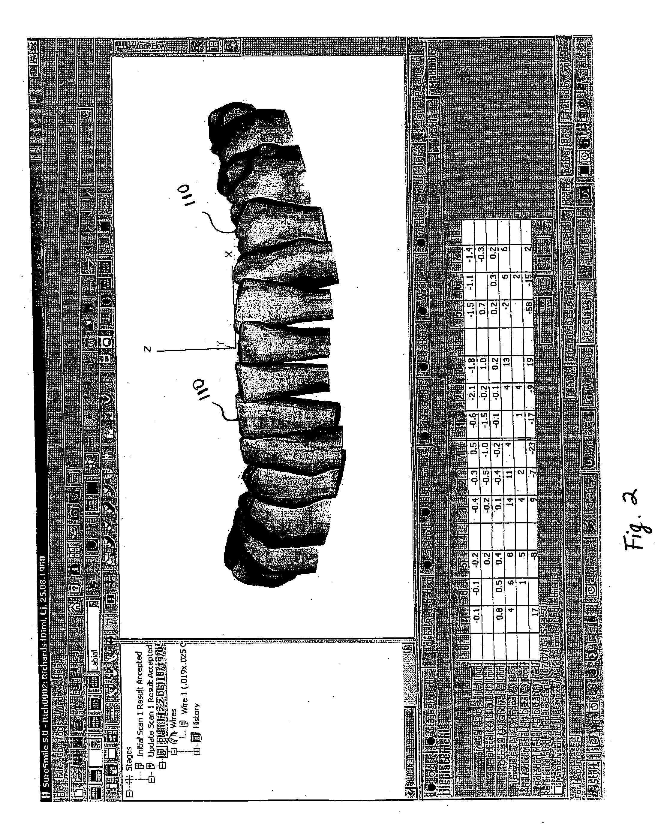 Method and apparatus for digitally evaluating insertion quality of customized orthodontic arch wire