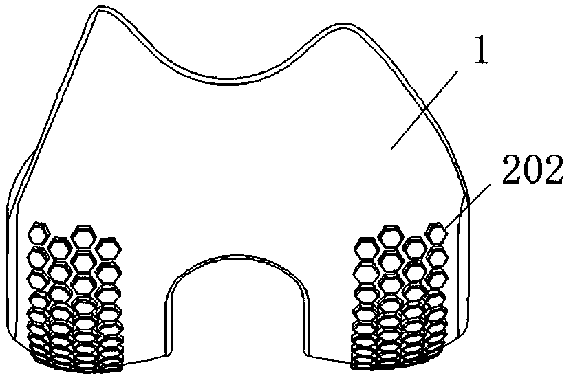 Knee joint prosthesis