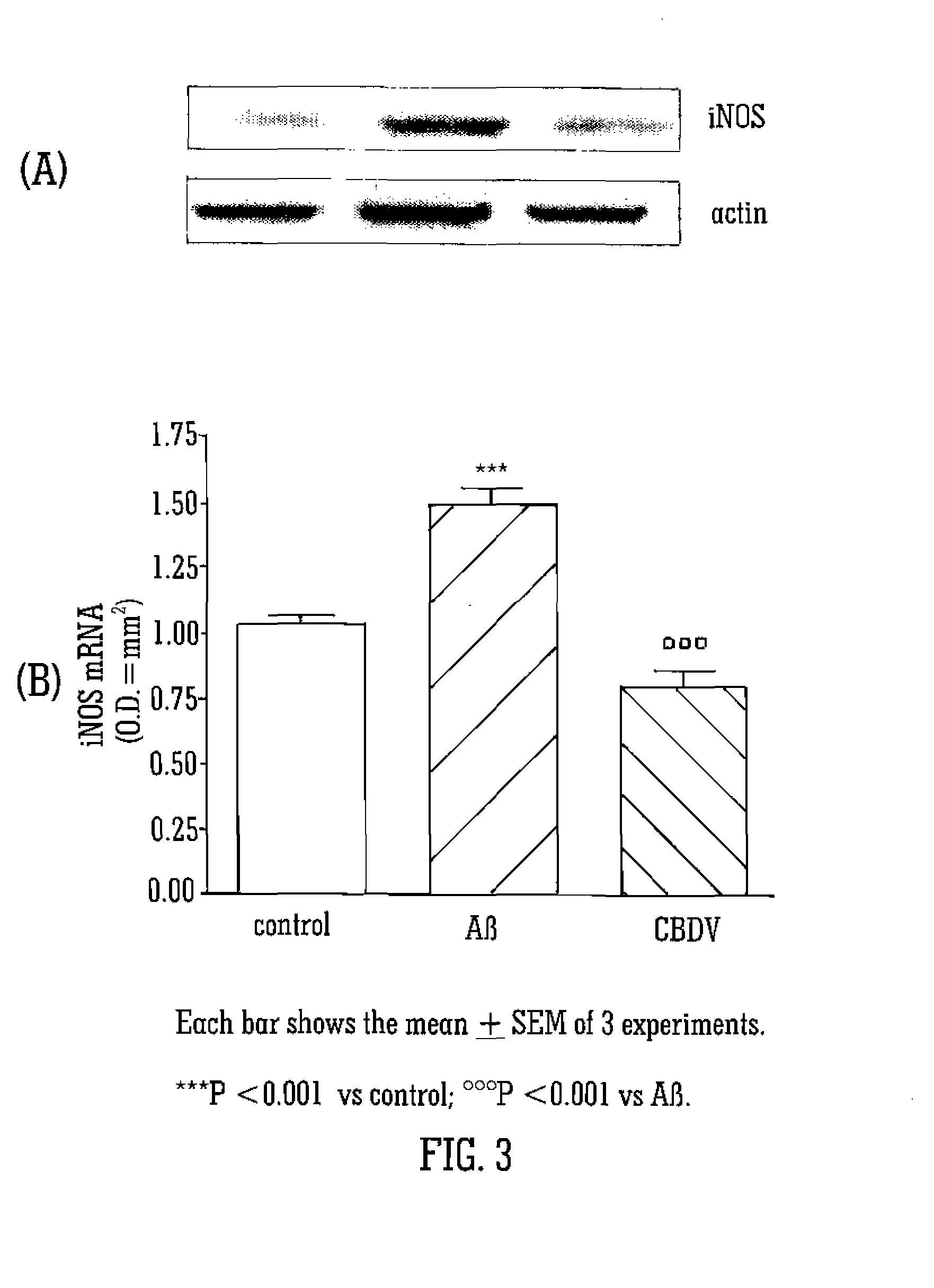 Cannabinoids for use in the treatment of neurodegenerative diseases or disorders