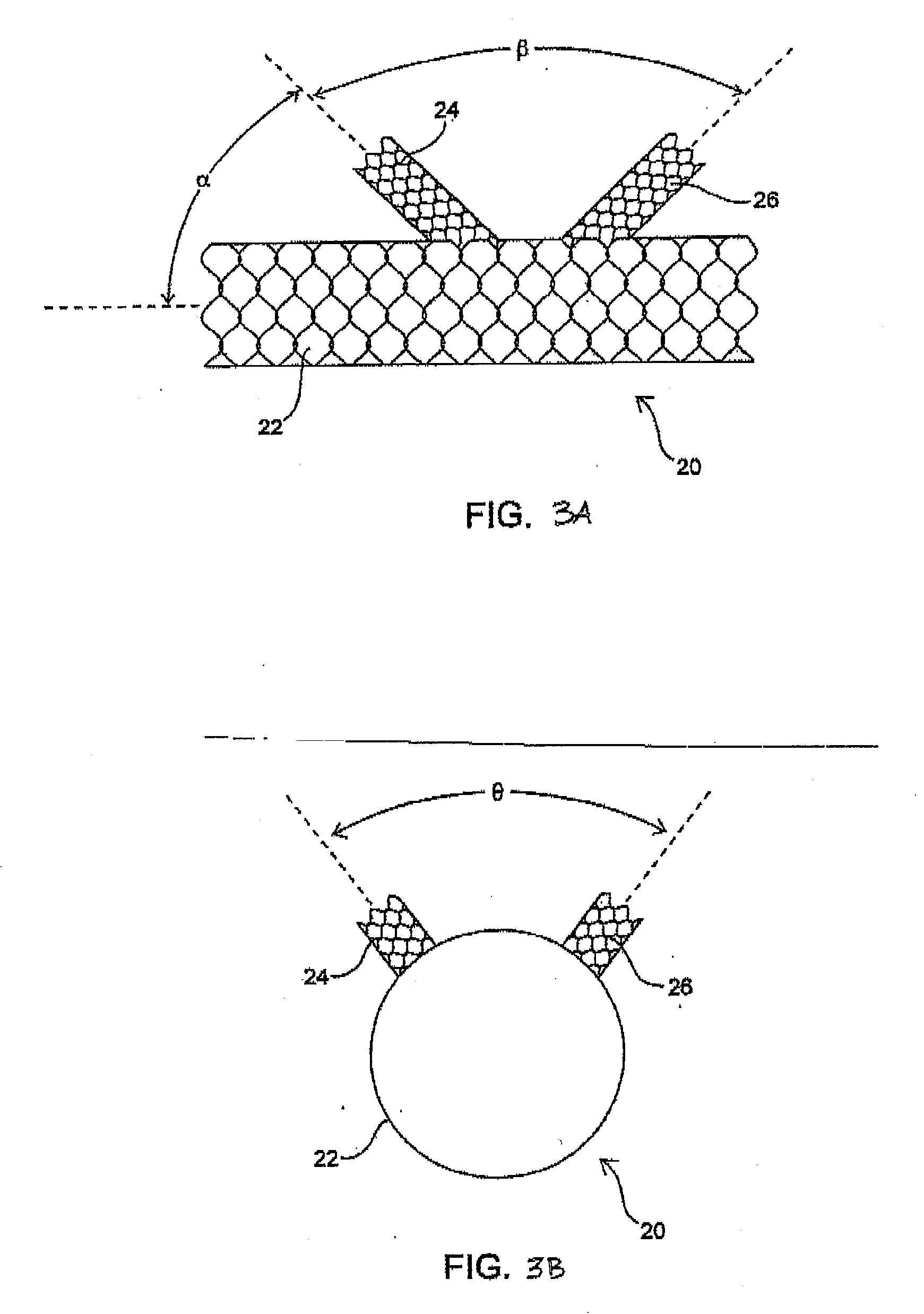 Vascular implants and methods of fabricating the same