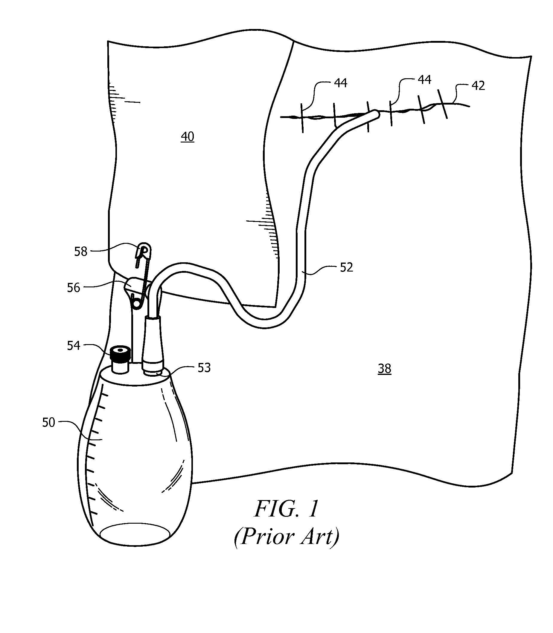 Method and apparatus for supporting a drainage bag