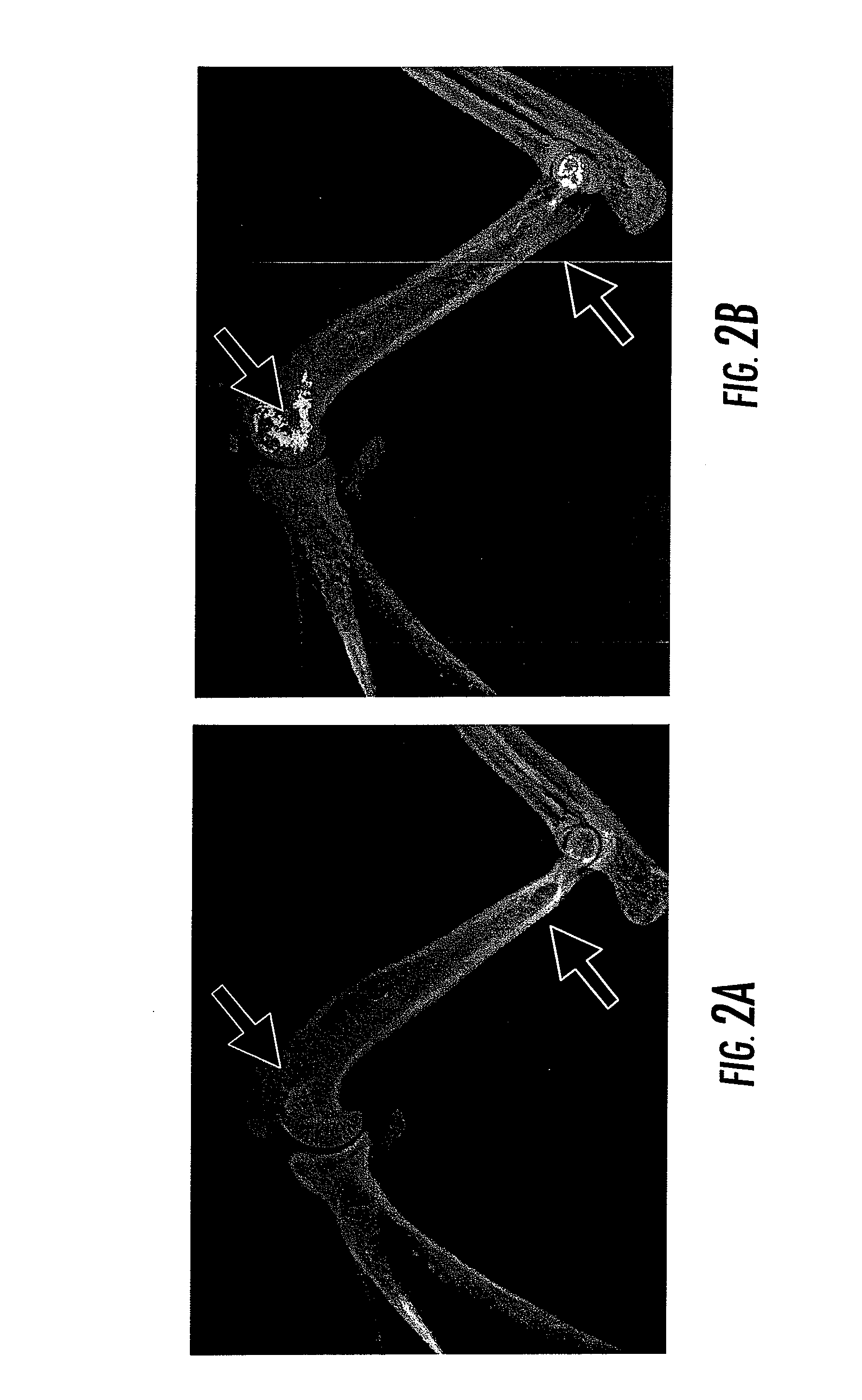 Compositions and Methods for the Treatment of Musculoskeletal Related Diseases and Disorders Using Metal Ion-Citrate Analog Complexes