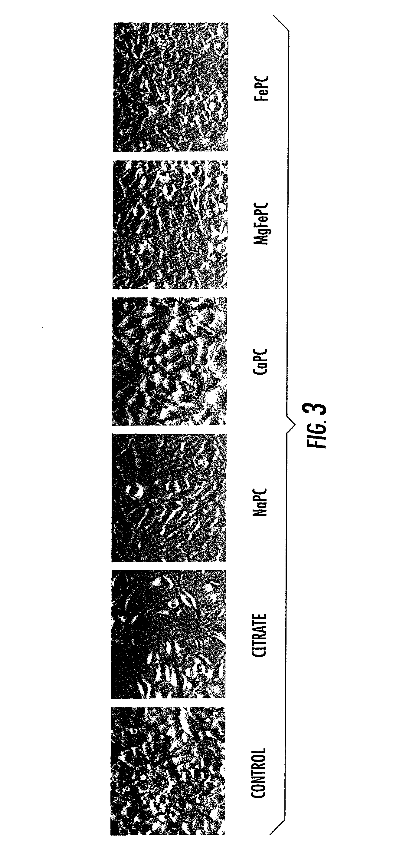 Compositions and Methods for the Treatment of Musculoskeletal Related Diseases and Disorders Using Metal Ion-Citrate Analog Complexes