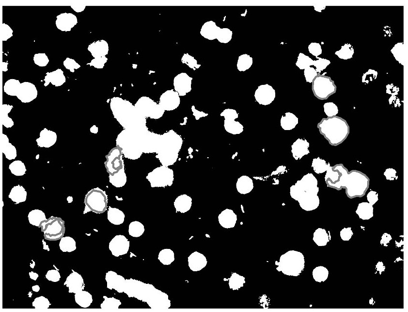 Distinguishing Method of Fluorescence Microscopy Image Result