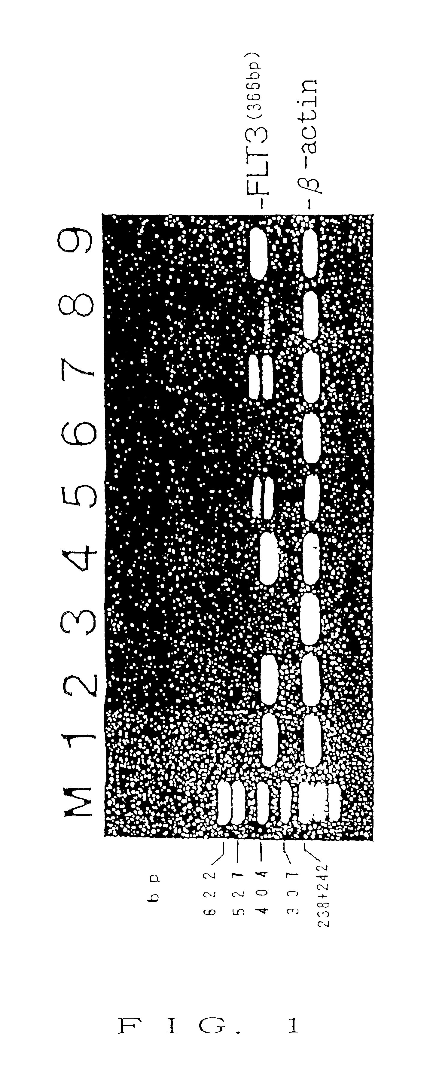 Nucleic acid encoding receptor type protein kinase