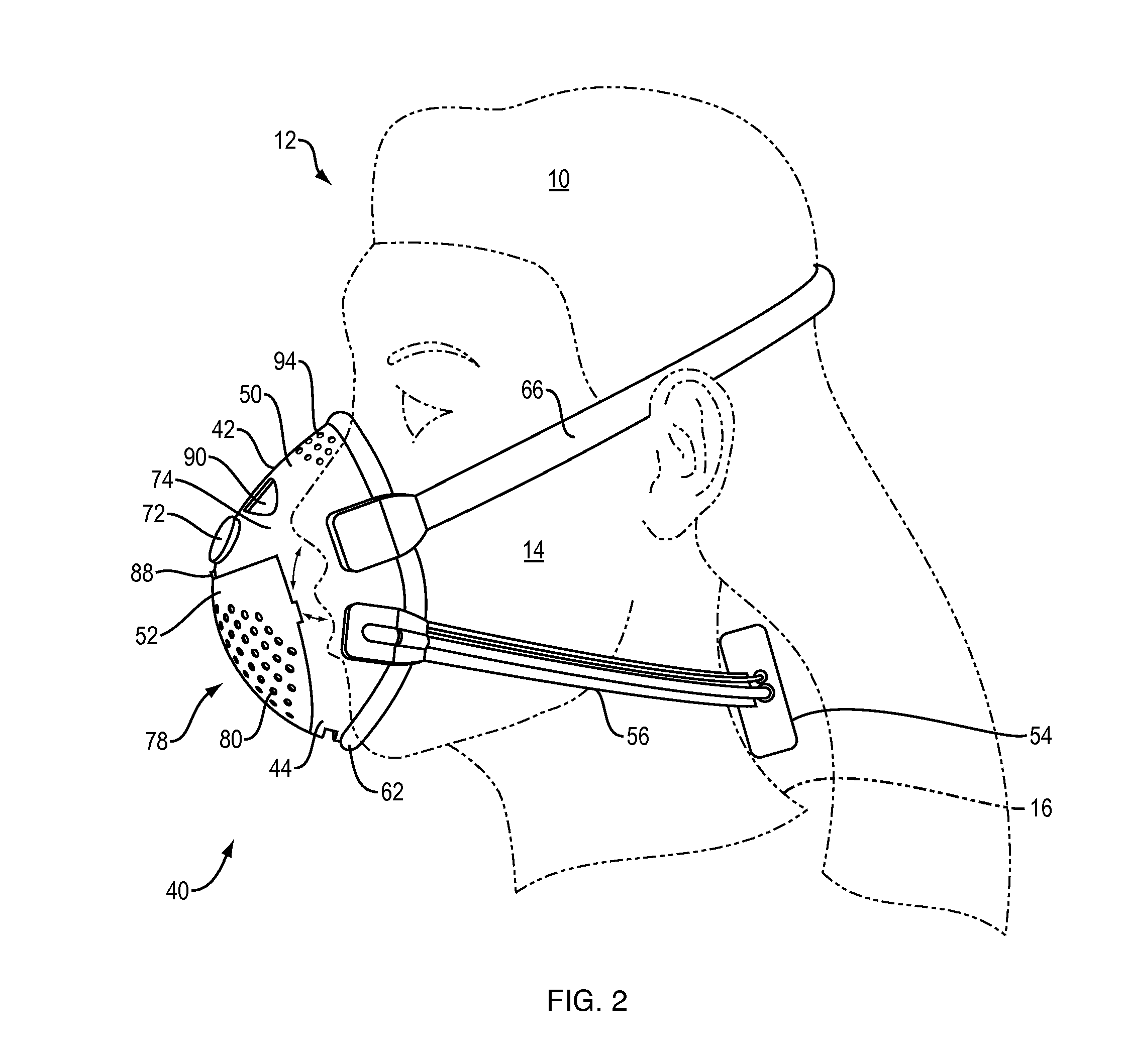 Cpap system with heat moisture exchange (HME) and multiple channel hose