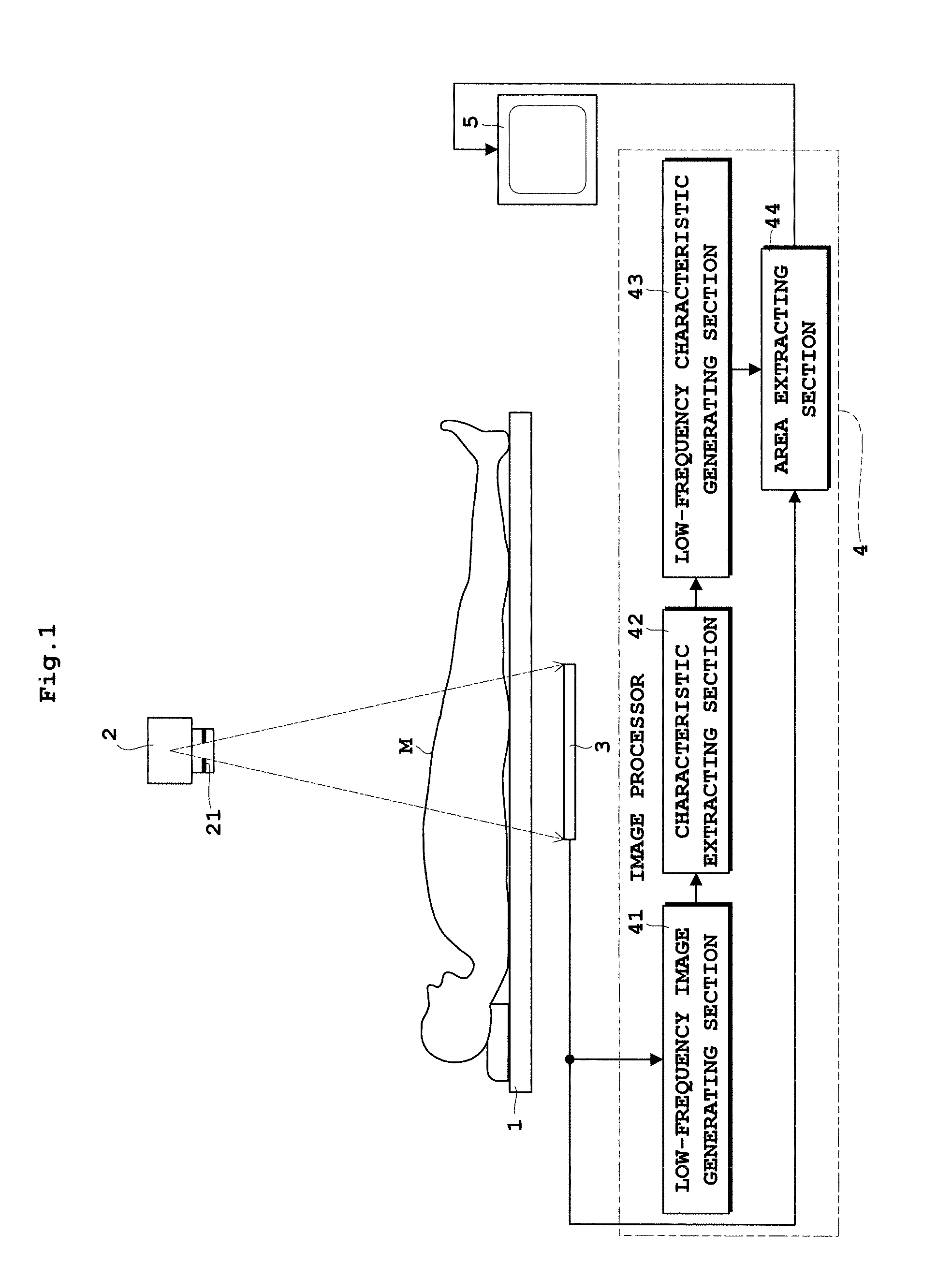 Radiographic image processing apparatus and radiographic image processing program