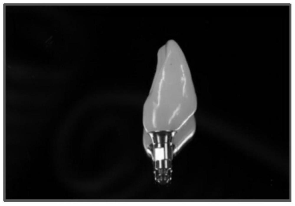 Individualized abutment-crown integration provisional prosthesis and preparation method and application thereof