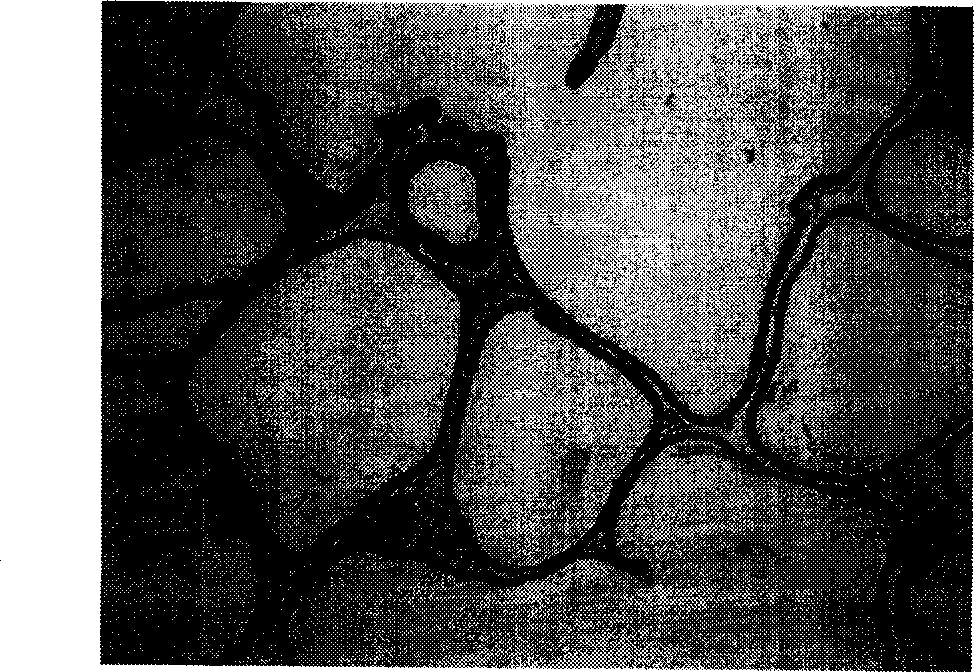 Application of compounds in isorhodanic ester classes for treating diseases of prostate and skin cancer