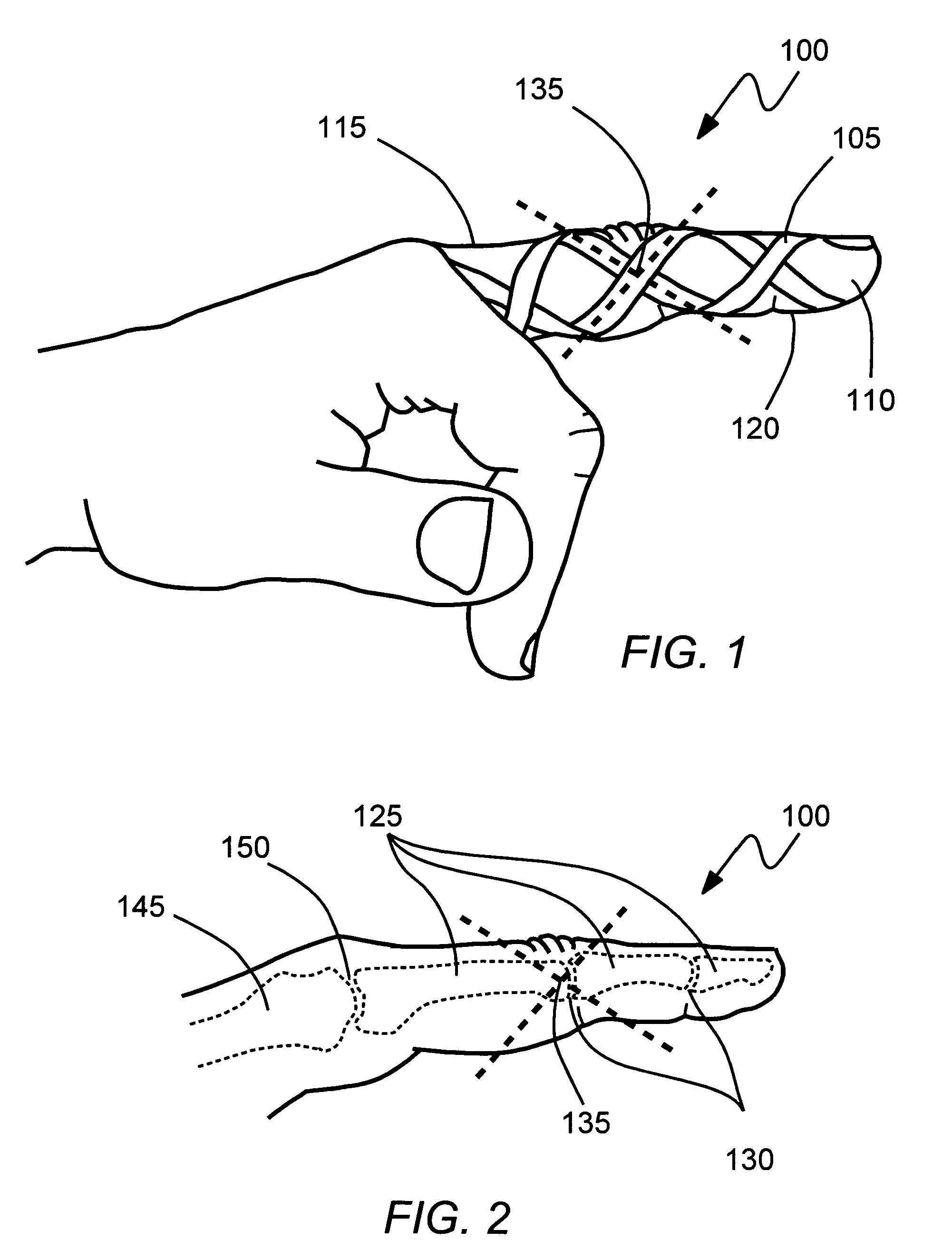 Glove reinforcement and method thereof