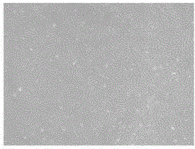 Construction method and application of hascs for overexpressing metallothionein