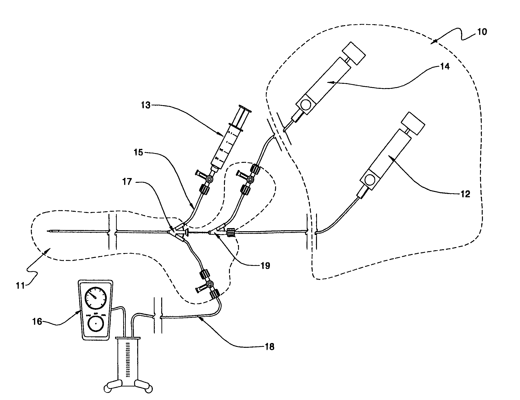 Fluid delivery systems for delivering fluids to multi-lumen catheters